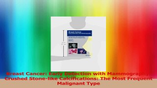 Breast Cancer Early Detection with Mammography Crushed Stonelike Calcifications The Download
