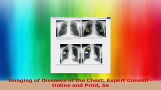 Imaging of Diseases of the Chest Expert Consult  Online and Print 5e PDF
