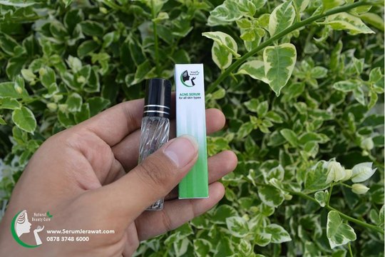 Serum Jerawat Qweena, SMS 0878 3748 6000