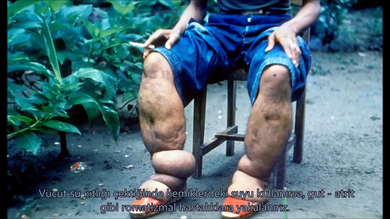 Su İçmeyi Bırakırsanız Ne Olur?