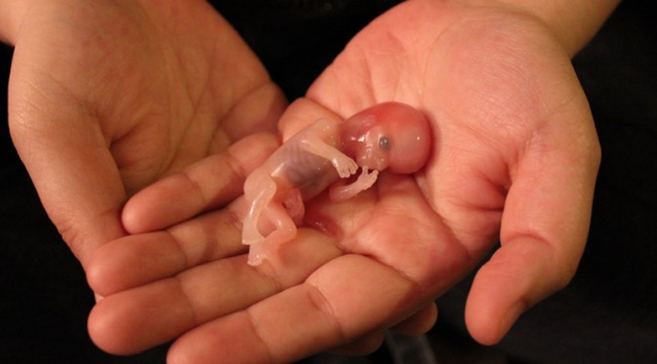 La grosse arnaque du téléthon
