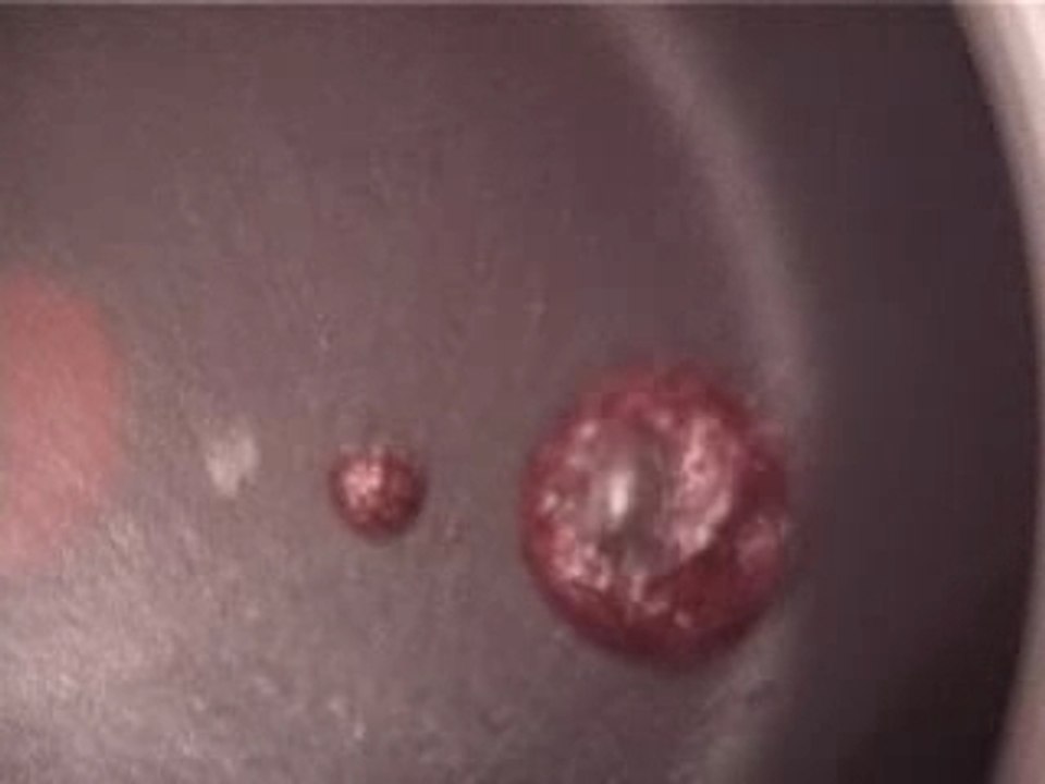 Blonde Redhead - My clip of Elephant Wom