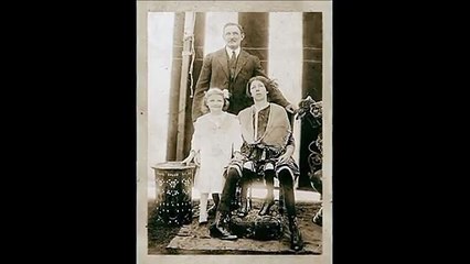 The four legged woman