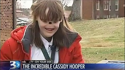 Girl Born With No Eyes or Nose Receives a Miracle