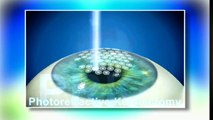 Refractive Lens Exchange Surgery Explained - Eye Surgeon Dr. Paul Dougherty
