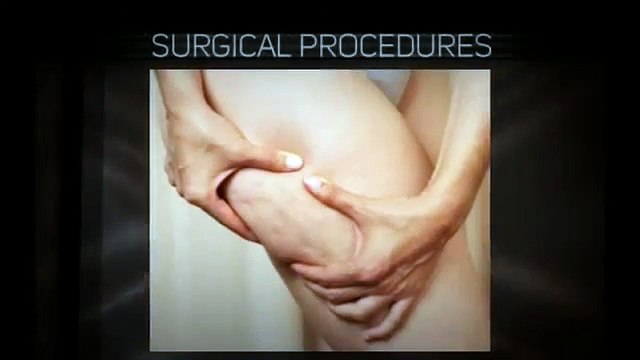 Laser treatment for tattoo removal in Tokyo Japan - PlazaClinic.net