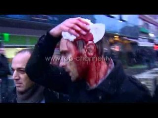 Kosovë, 30 ditë paraburgim deputetëve Kurteshi dhe Shala - Top Channel Albania - News - Lajme