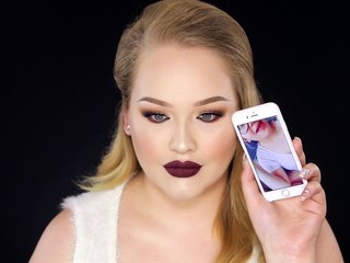 MY LIP INJECTIONS | Q&A!