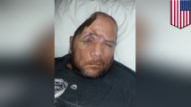 Unarmed man sues Los Angeles police for messing up his head in 'unprovoked' shooting