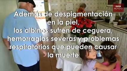 La familia de albinos en Puerto Rico que vive aislada de la sociedad