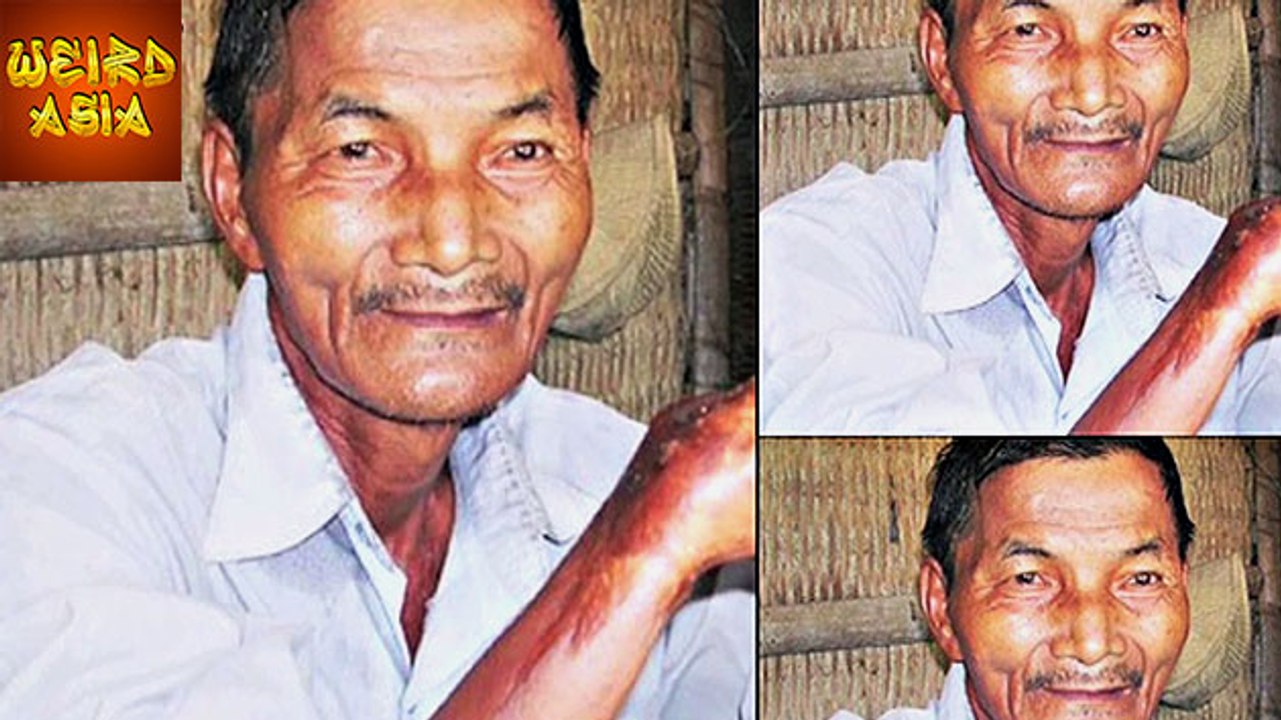 Man Who Hasn't Slept For Over 30 Years | Weird Asia