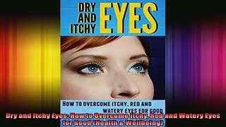 Dry and Itchy Eyes How to Overcome Itchy Red and Watery Eyes for Good Health