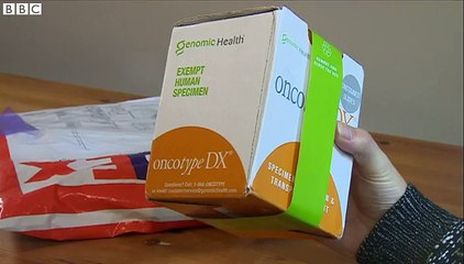 Bristol man delivered tumour sample by mistake