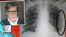 OMG! Amitabh Bachchan's Ribs DAMAGED