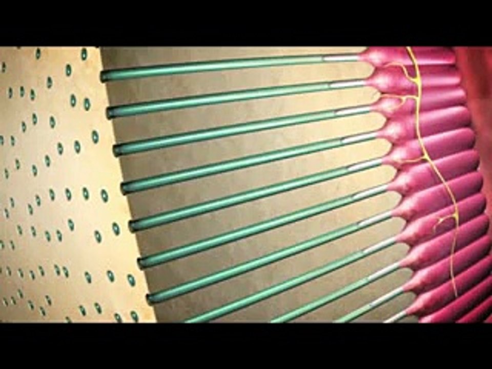 Coorparoo Dentists - Video on Understanding Tooth Sensitivity