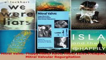 Mitral Valve Floppy Mitral Valve Mitral Valve Prolapse Mitral Valvular Regurgitation Download