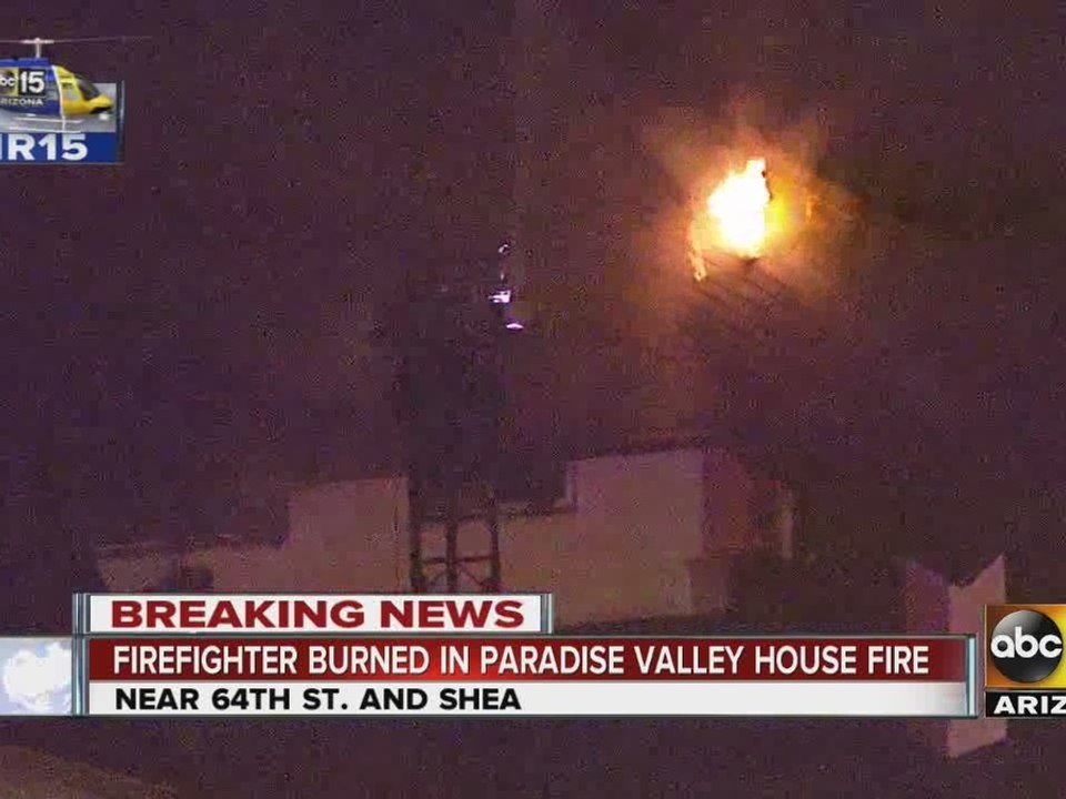 Firefighter burned while extinguishing flames