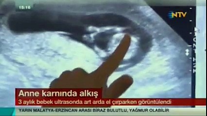 3 aylık bebek, Anne Karnında Bakın Ne Yaptı...