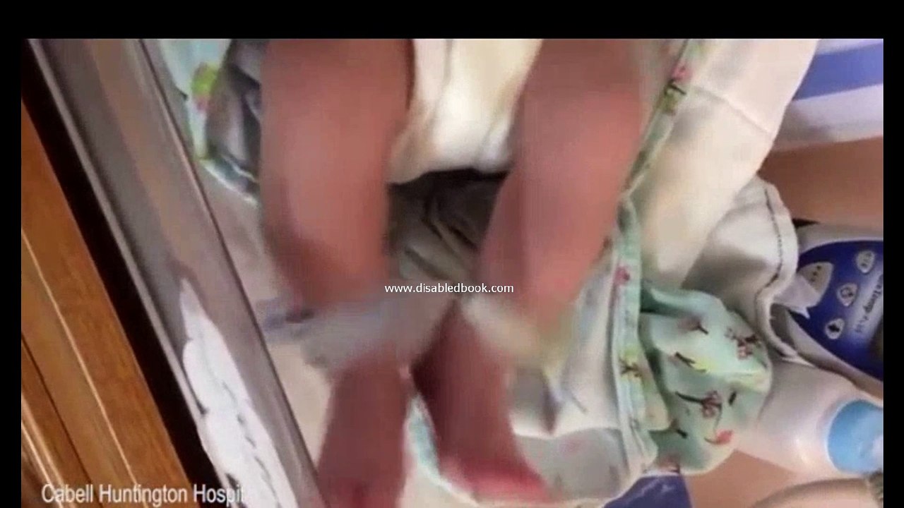 Νεογέννητο μωρο εθισμένο στην ηρωίνη