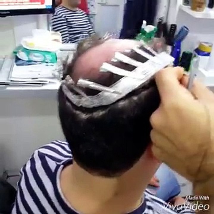 PROTEZ SAÇ DİKİKİMİ BANTSIZ SİSTEM