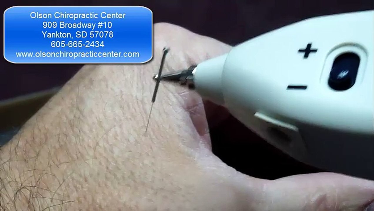 Acupuncture Needle Electrical Stimulation Yankton Chiropractor