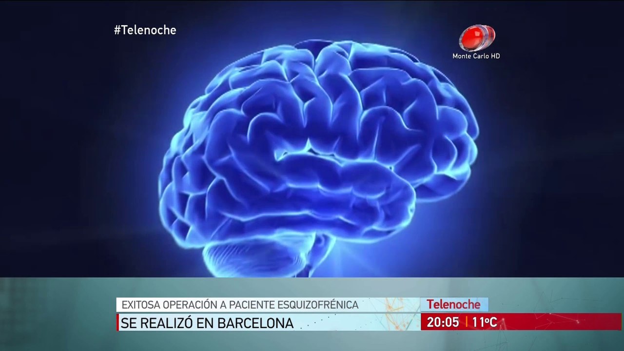 Avances en salud : Existosa operacion a paciente esquizofrenica.