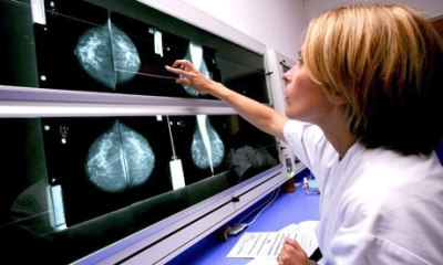 'স্তন ক্যানসার পরীক্ষায় ৪০ ভাগ মৃত্যু কমে'