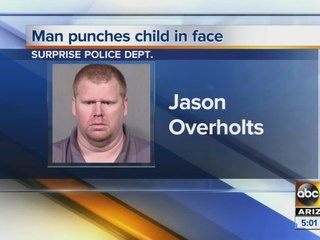 Child punched in face by man in Surprise