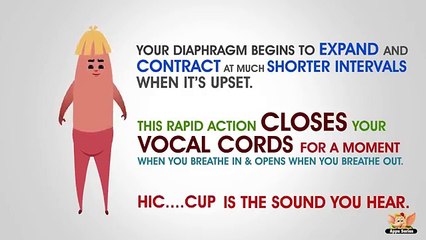 Why do you get Hiccups