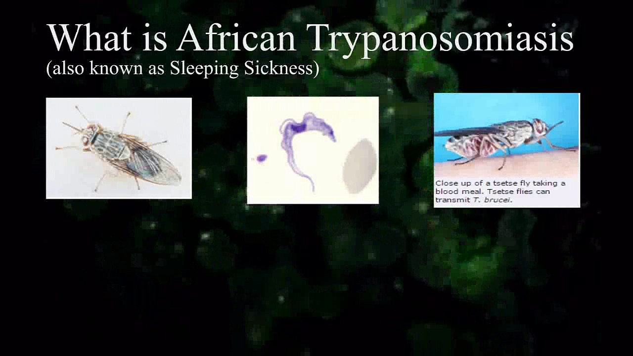 Health is Wealth - What is  African Sleeping Sickness (African trypanosomiasis)