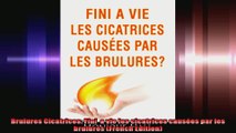 Brulures Cicatrices Fini  a vie les cicatrices causées par les brulures French Edition