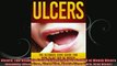 Ulcers The Ultimate Cure Guide for How to Get Rid of Mouth Ulcers Instantly Ulcer Free