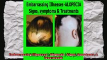 Embarrassing Illnesses  Alopecia  Signs Symptoms  Treatments