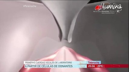 Avances en salud : Crean cuerdas vocales en laboratorio.