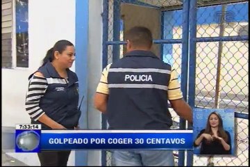Madre acusada de quemar las manos de su hijo por 30 centavos