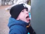 اس بچے کی زبان کیسے چپک گئ