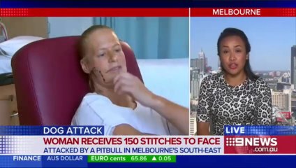 Woman left with 150 stitches after dog attack