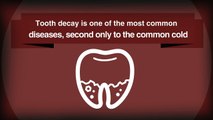 Are your teeth strong enough to fight tooth decay?