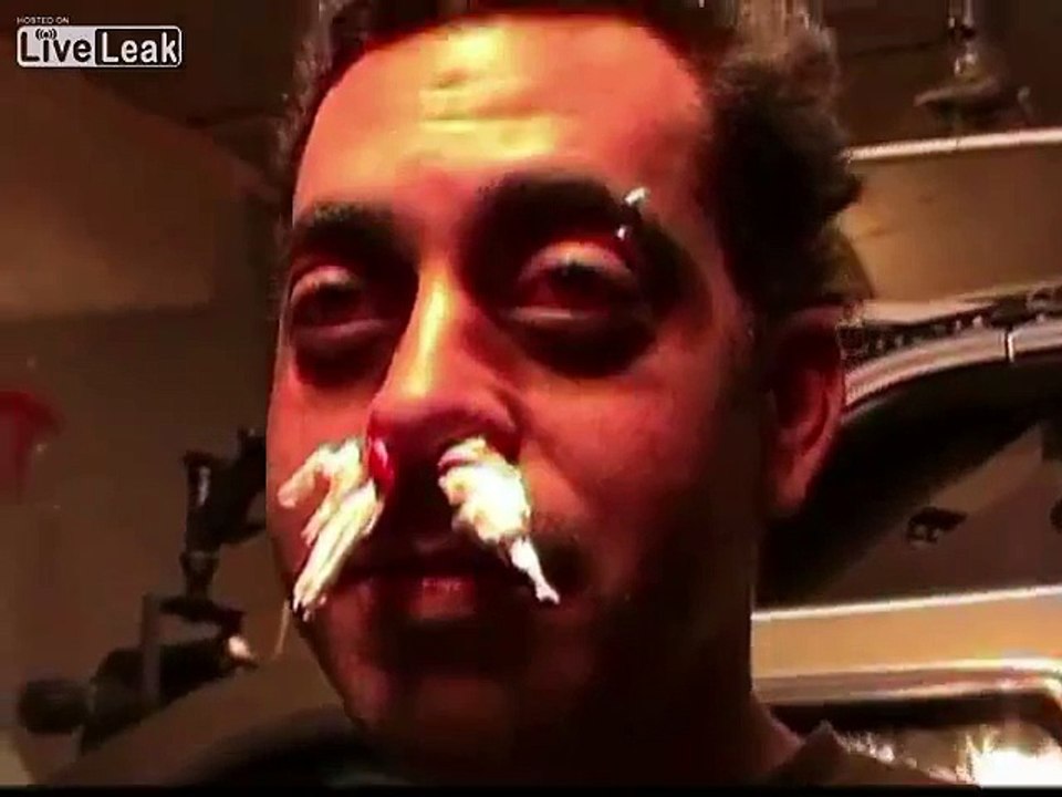 100 mph apple to the face