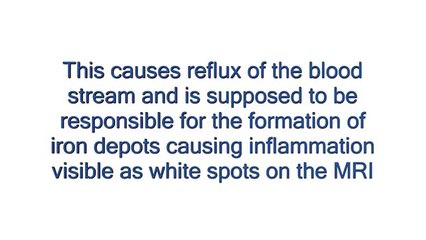 Multiple Sclerosis Treatment patients video