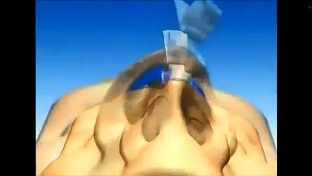 Rhinoplastie Tunisie - Chirurgie du nez