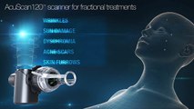 AcuPulse™ - MultiMode™ SuperPulse™ CO2 Fractional Laser