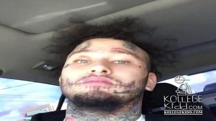 Stitches Responds To The Game's Fight Deal