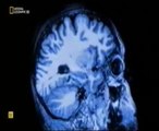 RM: Investigacion cerebral (Habenula)