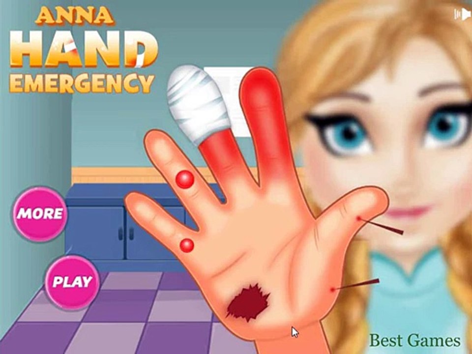 Frozen Anna Hand Emergency Disney Frozen Game Movie Top Online Baby Games For kids 2015