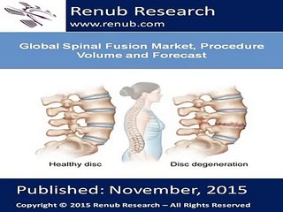 Global Spinal Fusion Market, Procedure Volume and Forecast