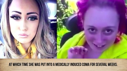 Shocking Before-And-After Drug Use Photos