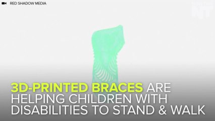 3D Printed Braces Help Kids With Disability Stand And Walk Again