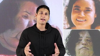 Top 10 Extreme Plastic Surgery Disasters