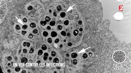 Sciences - Un ver contre les infections - 2015/12/23